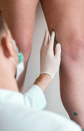 Consulta Médica Flebológica